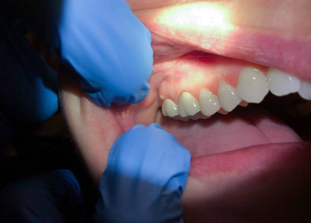 Best After-Hours Dental Care in Derwood, MD